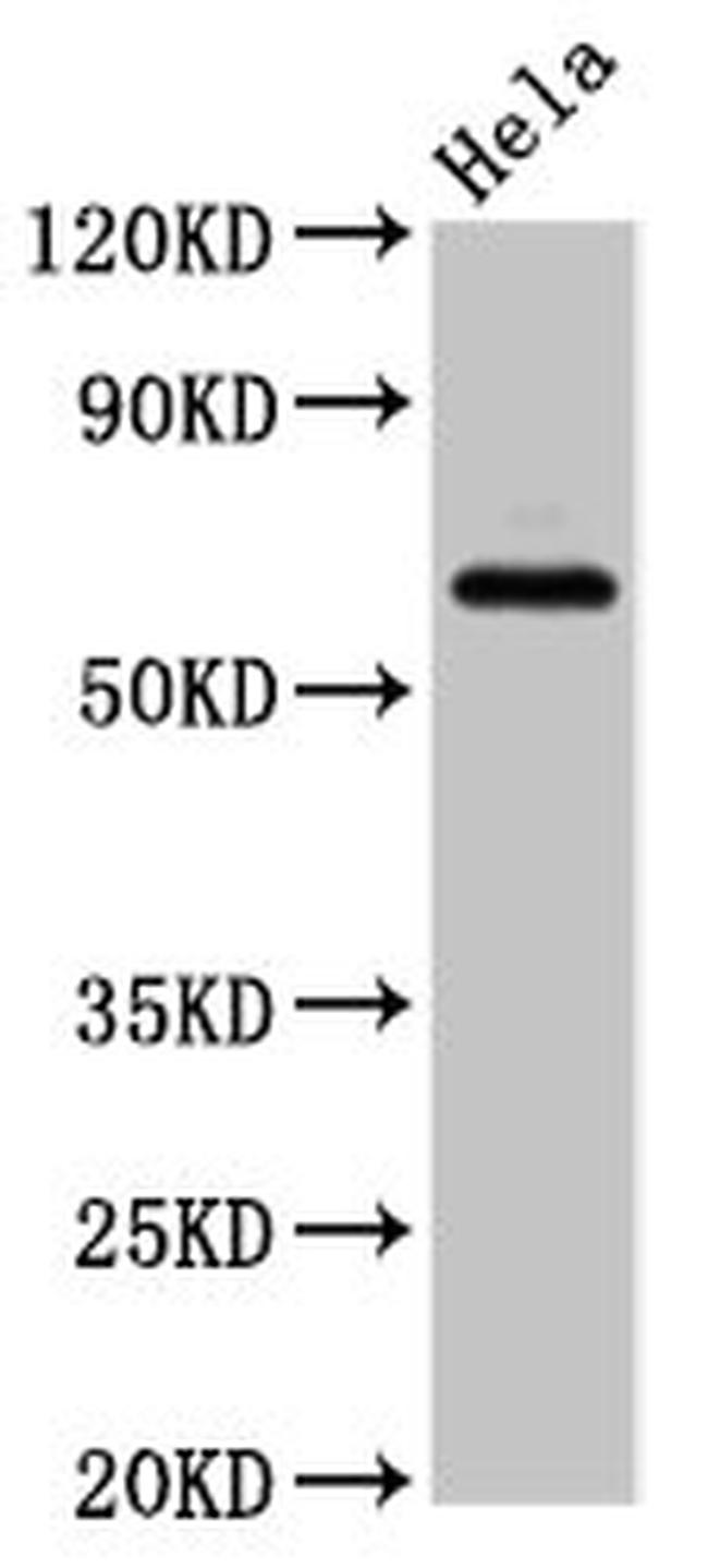 SLC22A25 Antibody in Western Blot (WB)