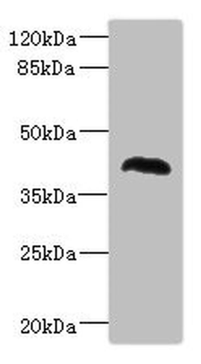 NHLRC1 Antibody in Western Blot (WB)