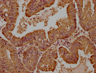 WDR73 Antibody in Immunohistochemistry (Paraffin) (IHC (P))