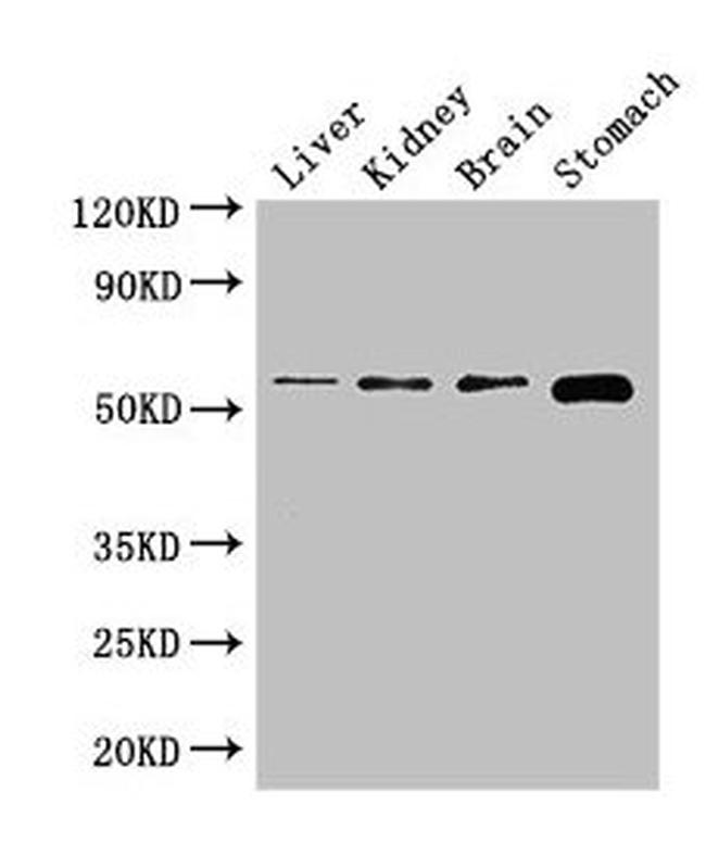 NOTUM Antibody in Western Blot (WB)