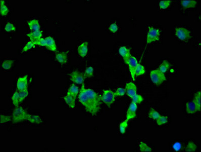 SCN10A Antibody in Immunocytochemistry (ICC/IF)