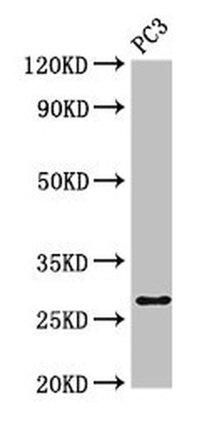 IL-34 Antibody in Western Blot (WB)