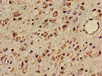 TTC27 Antibody in Immunohistochemistry (Paraffin) (IHC (P))