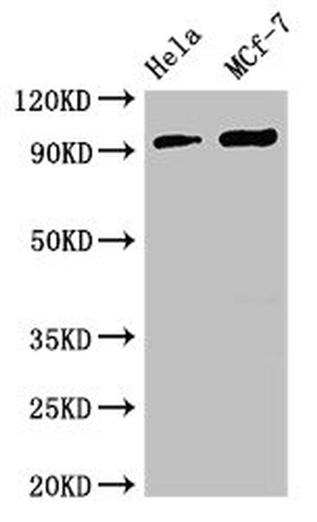 TTC27 Antibody in Western Blot (WB)