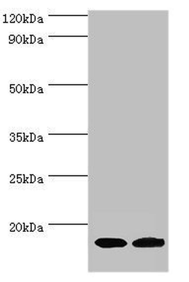 CPLX2 Antibody in Western Blot (WB)