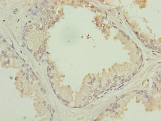 PTPLB Antibody in Immunohistochemistry (Paraffin) (IHC (P))