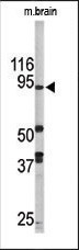 LSD1 Antibody in Western Blot (WB)