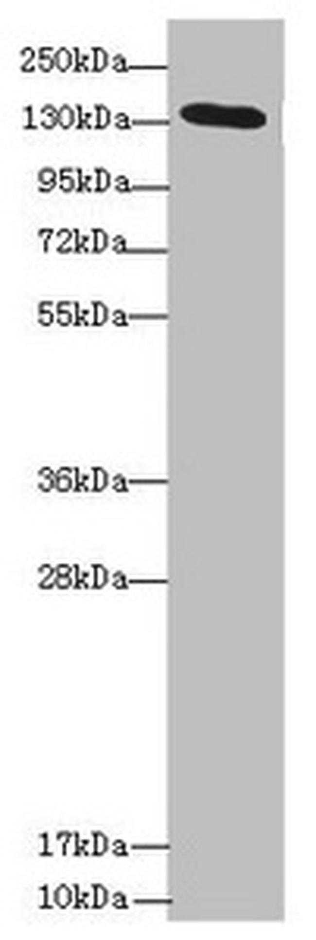 NPHP3 Antibody in Western Blot (WB)