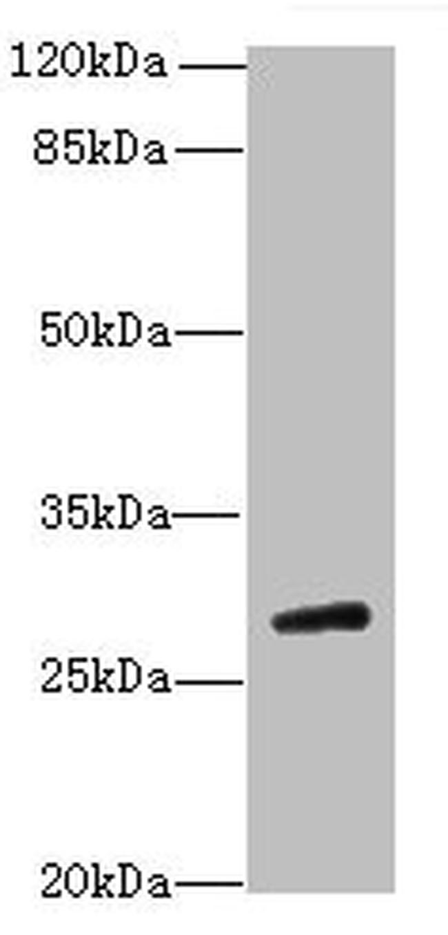TBC1D26 Antibody in Western Blot (WB)
