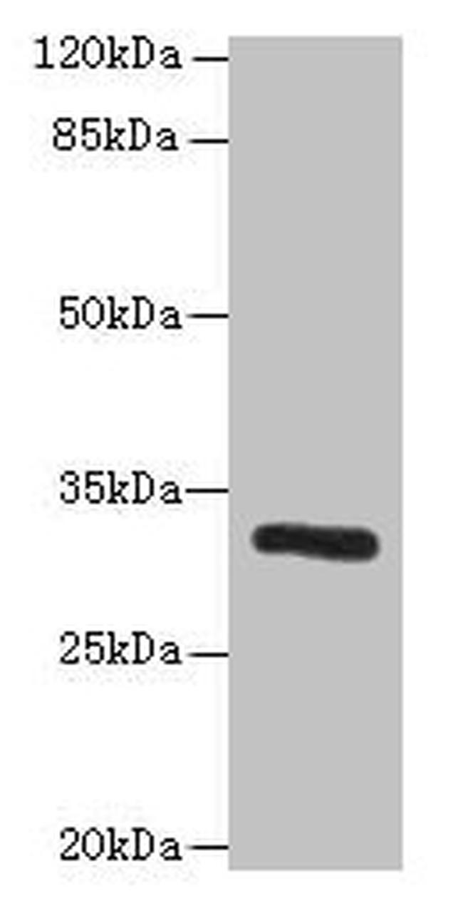 PPP1R3B Antibody in Western Blot (WB)