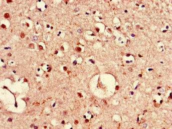 PIM3 Antibody in Immunohistochemistry (Paraffin) (IHC (P))