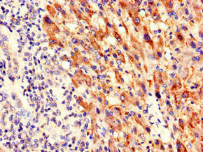 PIM3 Antibody in Immunohistochemistry (Paraffin) (IHC (P))