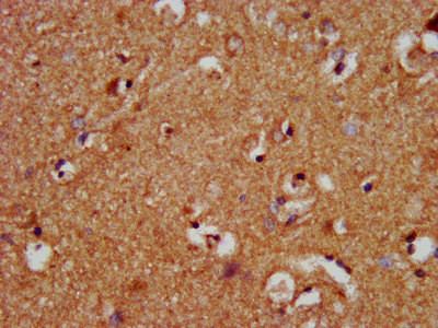 NALP10 Antibody in Immunohistochemistry (Paraffin) (IHC (P))