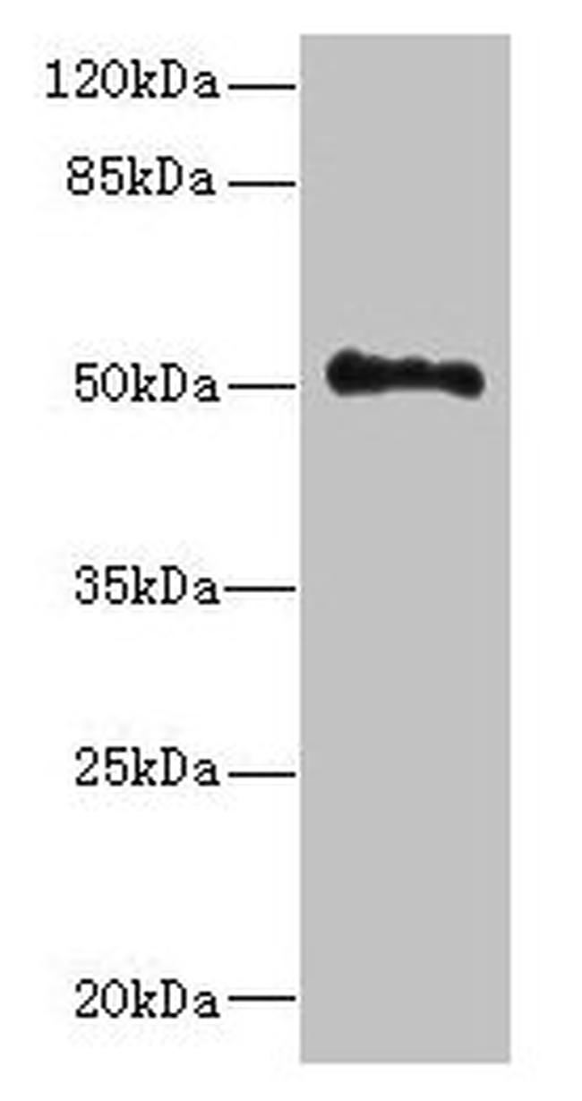 UNC93A Antibody in Western Blot (WB)
