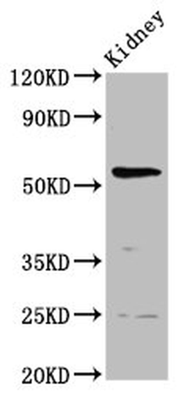 PIGW Antibody in Western Blot (WB)