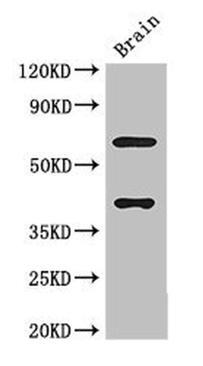 LRRTM4 Antibody in Western Blot (WB)