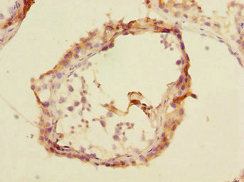 RNF36 Antibody in Immunohistochemistry (Paraffin) (IHC (P))