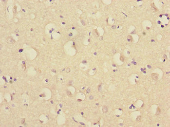 RNF36 Antibody in Immunohistochemistry (Paraffin) (IHC (P))