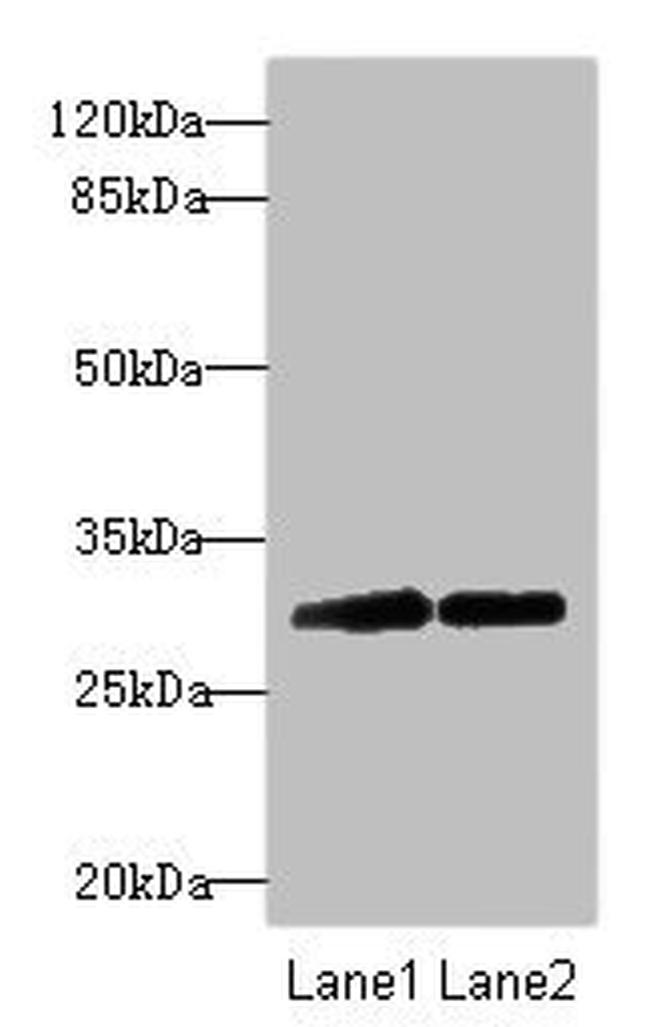 RNF36 Antibody in Western Blot (WB)