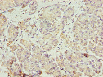 ERO1LB Antibody in Immunohistochemistry (Paraffin) (IHC (P))