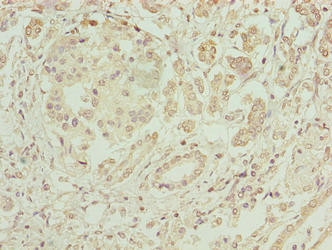 ERO1LB Antibody in Immunohistochemistry (Paraffin) (IHC (P))