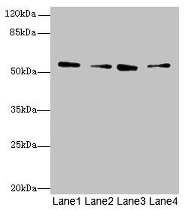 ERO1LB Antibody in Western Blot (WB)