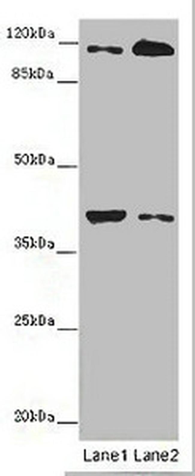 Allergin 1 Antibody in Western Blot (WB)