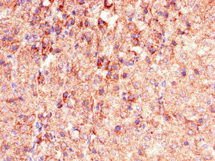 PHLDB2 Antibody in Immunohistochemistry (Paraffin) (IHC (P))