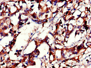 PHLDB2 Antibody in Immunohistochemistry (Paraffin) (IHC (P))