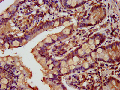 GATAD2A Antibody in Immunohistochemistry (Paraffin) (IHC (P))