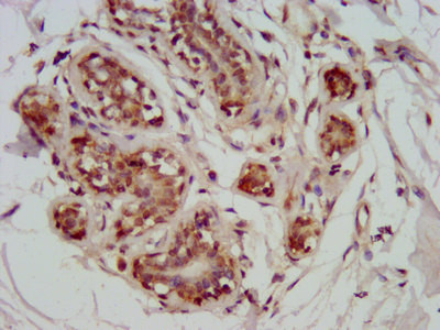 GATAD2A Antibody in Immunohistochemistry (Paraffin) (IHC (P))