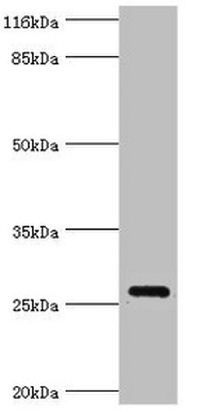 OFCC1 Antibody in Western Blot (WB)