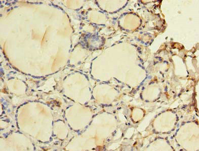 WDR49 Antibody in Immunohistochemistry (Paraffin) (IHC (P))