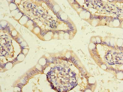 WDR49 Antibody in Immunohistochemistry (Paraffin) (IHC (P))