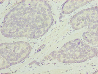 ODF3L1 Antibody in Immunohistochemistry (Paraffin) (IHC (P))