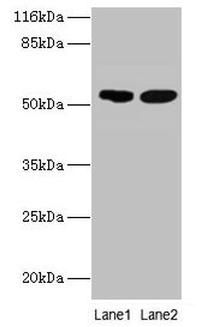 SVOPL Antibody in Western Blot (WB)