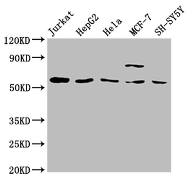 SLC37A2 Antibody in Western Blot (WB)