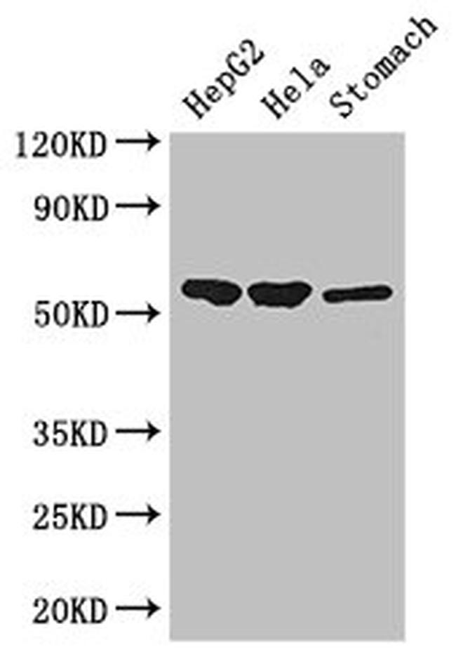 SLC37A2 Antibody in Western Blot (WB)