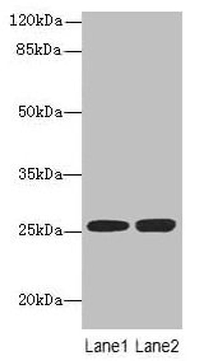 N6AMT2 Antibody in Western Blot (WB)