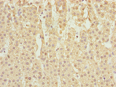 NORE1 Antibody in Immunohistochemistry (Paraffin) (IHC (P))