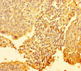 RTF1 Antibody in Immunohistochemistry (Paraffin) (IHC (P))