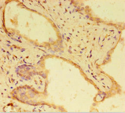 RTF1 Antibody in Immunohistochemistry (Paraffin) (IHC (P))