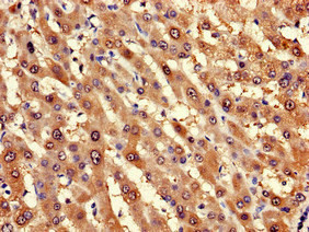 LPGAT1 Antibody in Immunohistochemistry (Paraffin) (IHC (P))