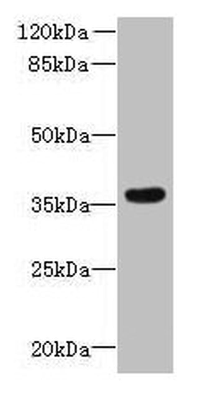 ZDHHC12 Antibody in Western Blot (WB)