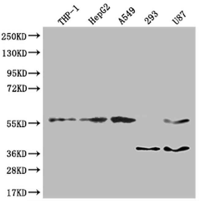 TSNARE1 Antibody in Western Blot (WB)