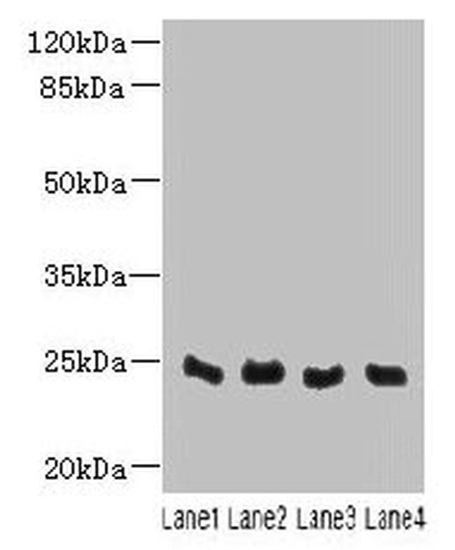 C4orf33 Antibody in Western Blot (WB)