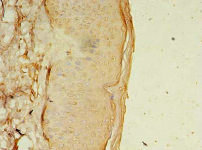 OSR2 Antibody in Immunohistochemistry (Paraffin) (IHC (P))