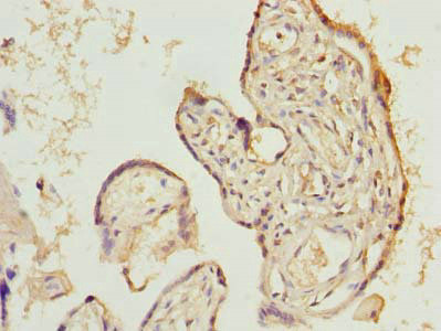 LIX1 Antibody in Immunohistochemistry (Paraffin) (IHC (P))