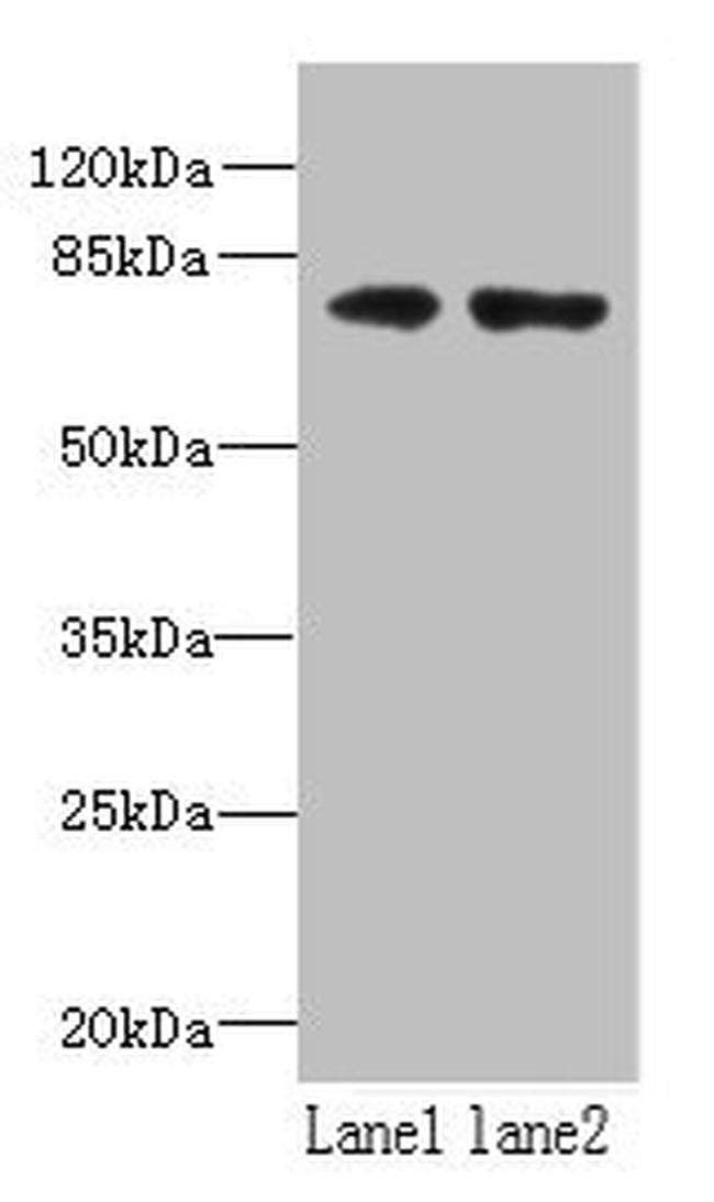 WDTC1 Antibody in Western Blot (WB)