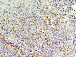 IL-22 Receptor alpha Antibody in Immunohistochemistry (Paraffin) (IHC (P))